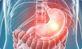 Normalizza la funzione intestinale