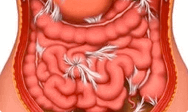 I parassiti danneggiano gli organi interni