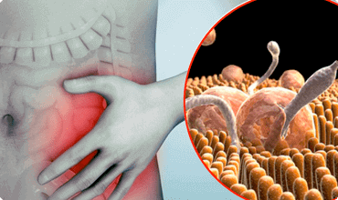 I parassiti causano allergie